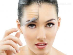 Eyebrow and Forehead Lift 